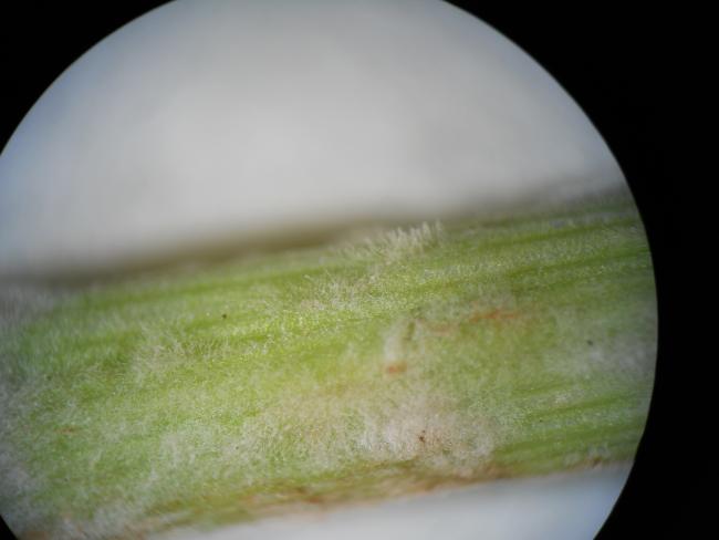 2b kép. Búzalisztharmat micéliumszövedékén képződő konídiumtartók és konídiumláncok tömege