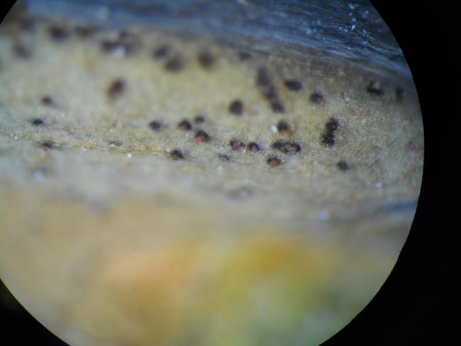 9. ábra A piknídiumokból kitüremkedő piknídiospóra-halmaz, mikroszkóp alatt
