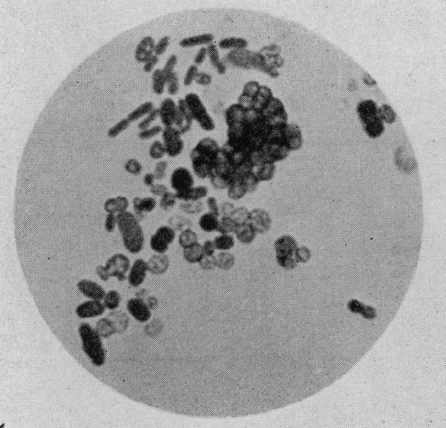 Azotobacter_cells[1]